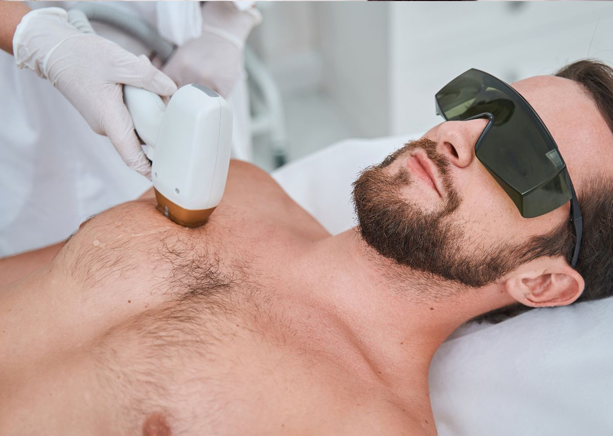 Upper_Body_Hair_Removal